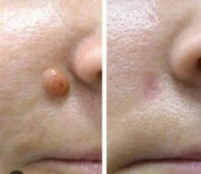 Lany Massoterapeuta — Massagem em ALDEOTA, Fortaleza