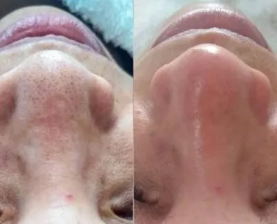 Lany Massoterapeuta — Massagem em Fortaleza — foto 2